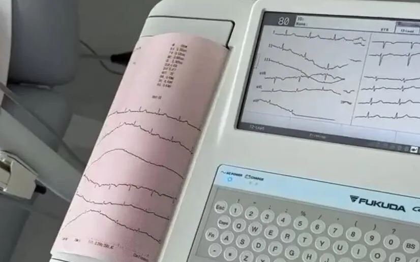 EKG přístroj v ordinaci praktického lékaře