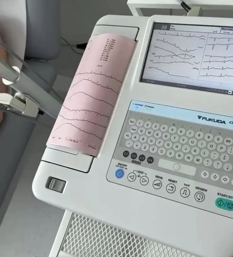 ECG machine in the general practice office
