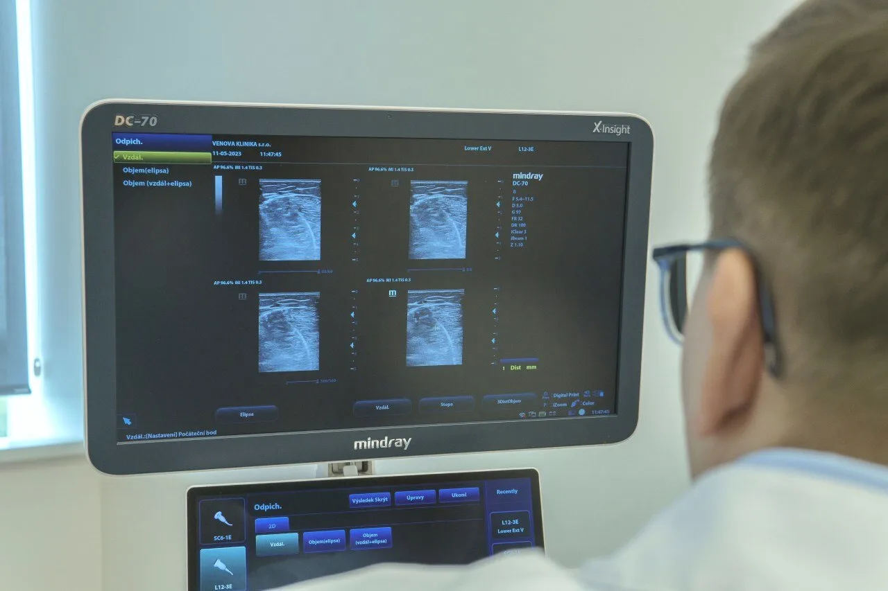 Doctor reviewing ultrasound findings