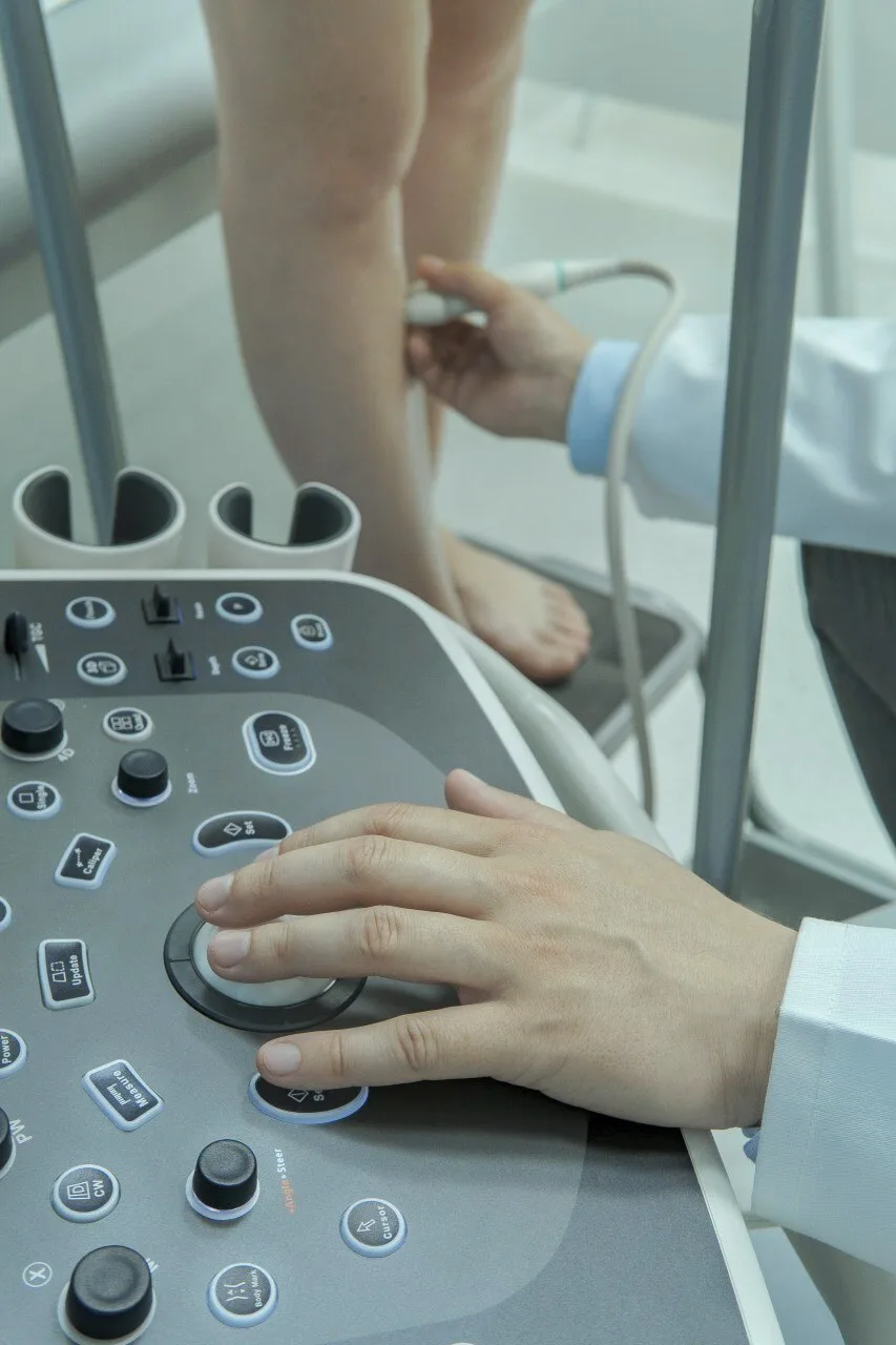 Vein ultrasound examination